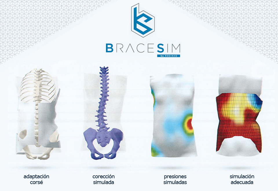 Bracesim. Permite simular el efecto que tendrá un corsé antes de fabricarlo.